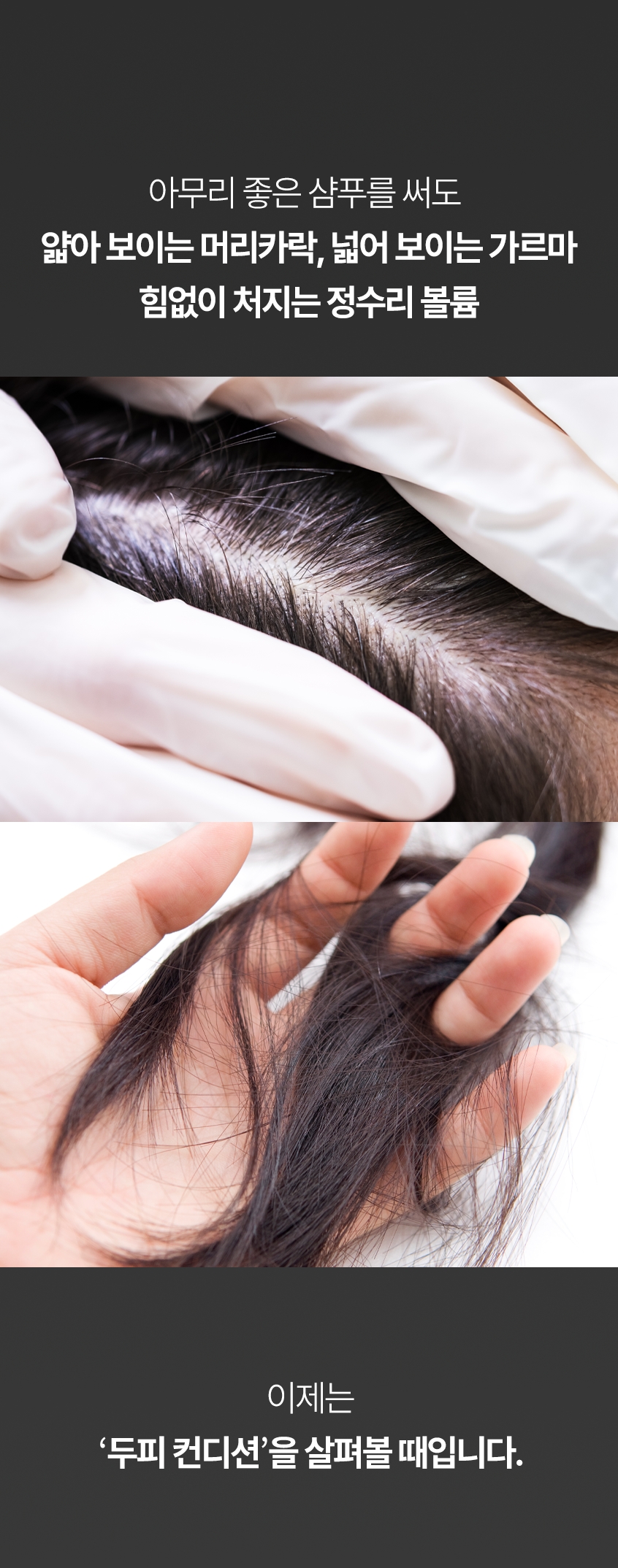 정수리 빈 이미지